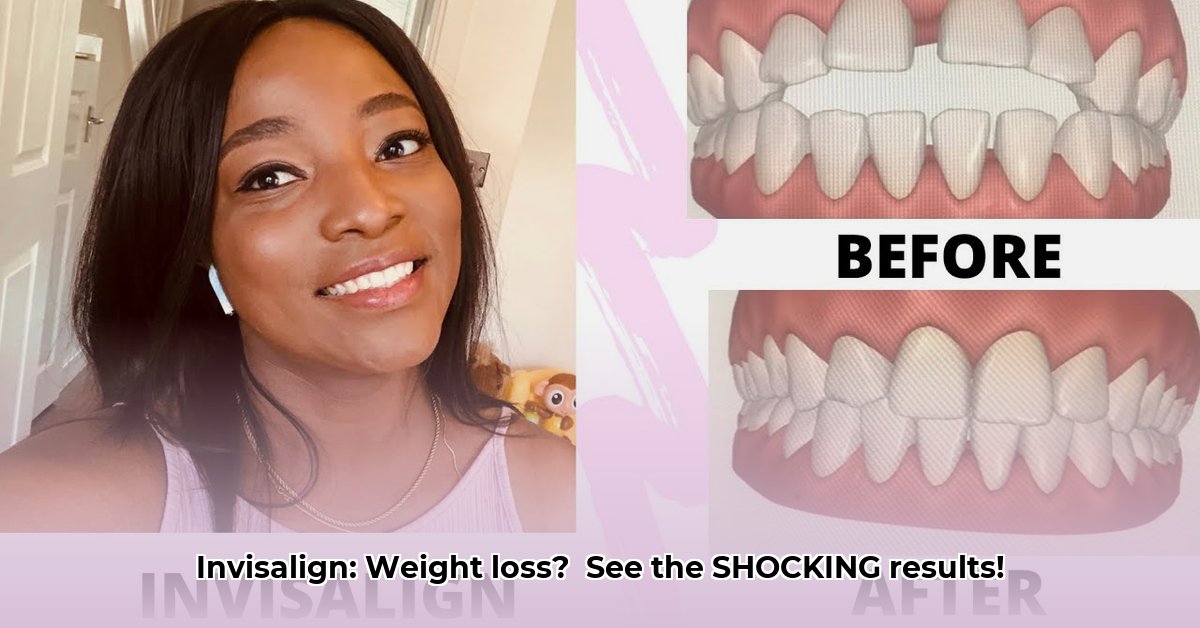 invisalign-weight-loss-before-and-after